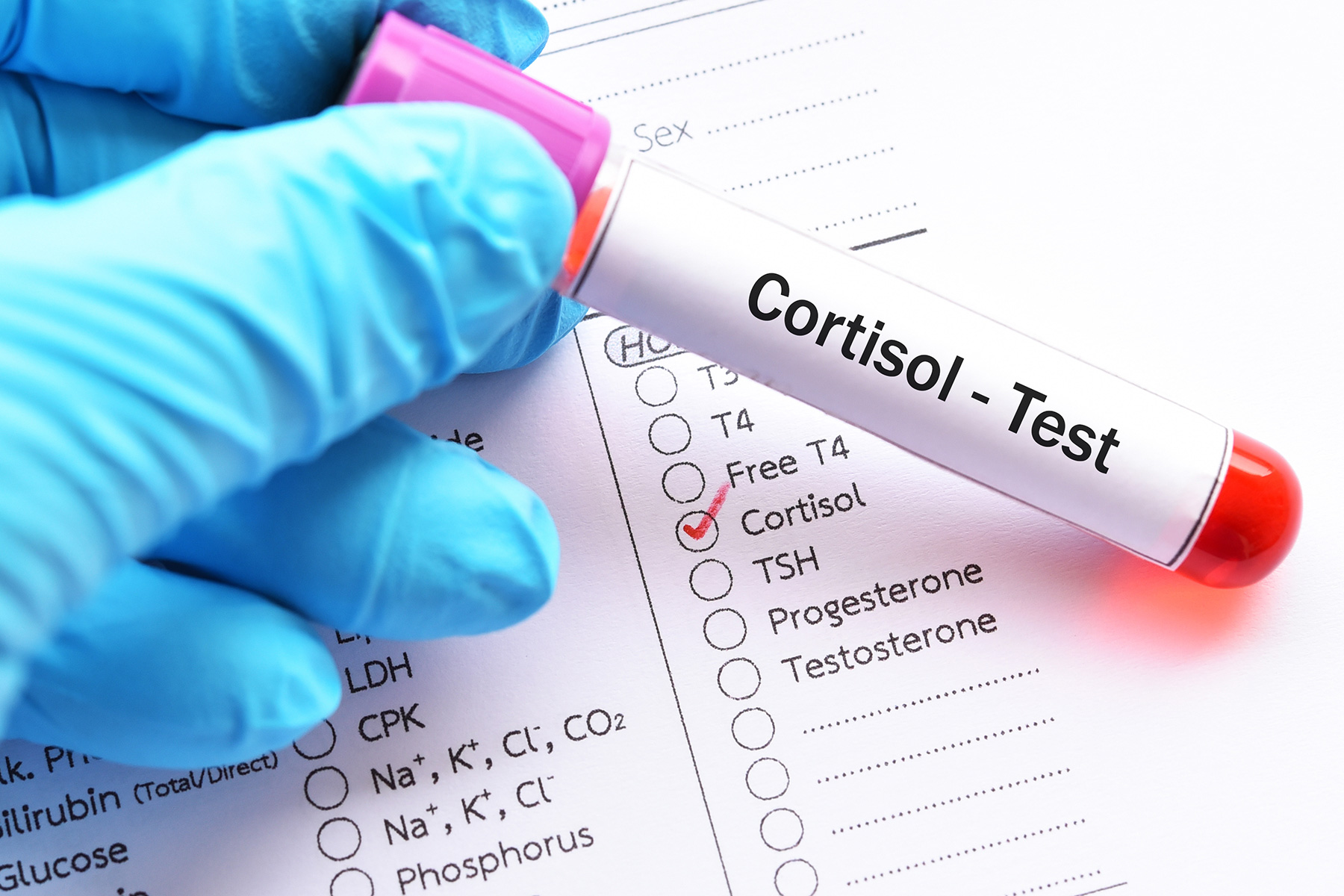 Simple blood tests are used to measure cortisol levels in the blood.